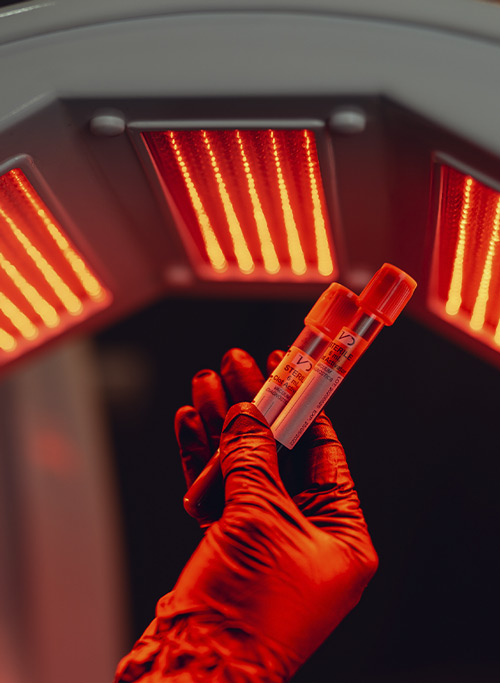 plasma